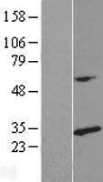 RPL14 Human Over-expression Lysate