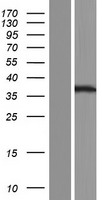 YIF1B Human Over-expression Lysate