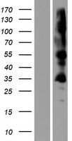 ZDHHC19 Human Over-expression Lysate