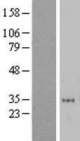 ZNF705D Human Over-expression Lysate