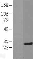 IAH1 Human Over-expression Lysate