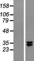 C20orf7 (NDUFAF5) Human Over-expression Lysate