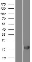 RGS21 Human Over-expression Lysate
