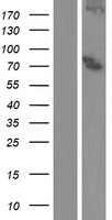 15 Lipoxygenase 2 (ALOX15B) Human Over-expression Lysate
