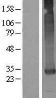 CASTOR1 Human Over-expression Lysate
