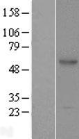 ACPL2 (PXYLP1) Human Over-expression Lysate