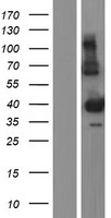 SCML1 Human Over-expression Lysate