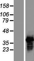 SFRS7 (SRSF7) Human Over-expression Lysate