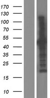 KIAA1712 (CEP44) Human Over-expression Lysate