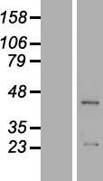 ACTR3B Human Over-expression Lysate