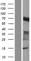 CCDC85A Human Over-expression Lysate