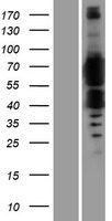 FTO Human Over-expression Lysate