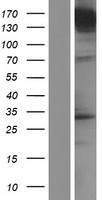 UNC13A Human Over-expression Lysate