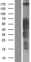 CCDC88C Human Over-expression Lysate