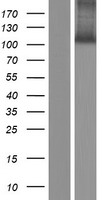 KIAA0146 (SPIDR) Human Over-expression Lysate