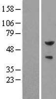 Pea3 (ETV4) Human Over-expression Lysate