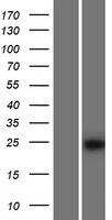 TVP23A Human Over-expression Lysate
