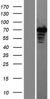 ZAP70 Human Over-expression Lysate