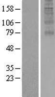 RTL8A Human Over-expression Lysate