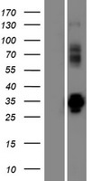 VPS37D Human Over-expression Lysate