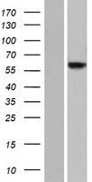 JRK Human Over-expression Lysate