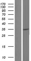 Constitutive androstane receptor (NR1I3) Human Over-expression Lysate