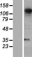 SEC31A Human Over-expression Lysate
