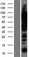 UBF1 (UBTF) Human Over-expression Lysate