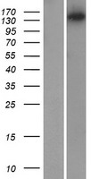 Myosin IIIB (MYO3B) Human Over-expression Lysate