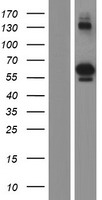 PTOP (ACD) Human Over-expression Lysate