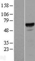 PTOP (ACD) Human Over-expression Lysate