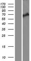 KLHL38 Human Over-expression Lysate