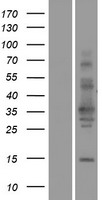 TSPAN11 Human Over-expression Lysate