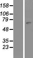 HSZFP36 (ZNF823) Human Over-expression Lysate