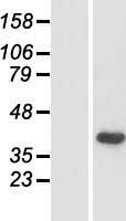 Pejvakin (DFNB59) Human Over-expression Lysate