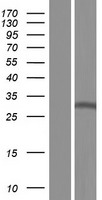 NSL1 Human Over-expression Lysate