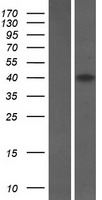 SPRED3 Human Over-expression Lysate
