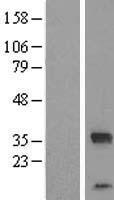 C14ORF140 (ZC2HC1C) Human Over-expression Lysate