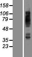 GLUT4 (SLC2A4) Human Over-expression Lysate
