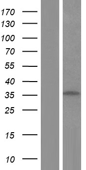 TNNT3 Human Over-expression Lysate