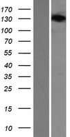 SEC24B Human Over-expression Lysate