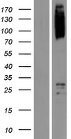 SCYL1 Human Over-expression Lysate
