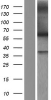 MYH (MUTYH) Human Over-expression Lysate
