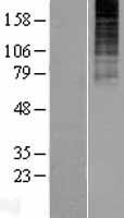 Neurokinin 3 Receptor NK3 (TACR3) Human Over-expression Lysate