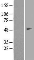 beta II Tubulin (TUBB2A) Human Over-expression Lysate