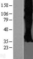 Somatostatin Receptor 3 (SSTR3) Human Over-expression Lysate