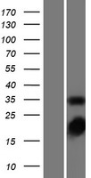 Thymidylate Synthase (TYMS) Human Over-expression Lysate