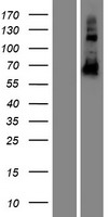 CCDC102B Human Over-expression Lysate