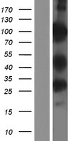 PWWP domain containing protein 2B (PWWP2B) Human Over-expression Lysate