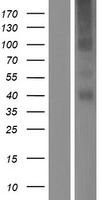 TMEM184A Human Over-expression Lysate